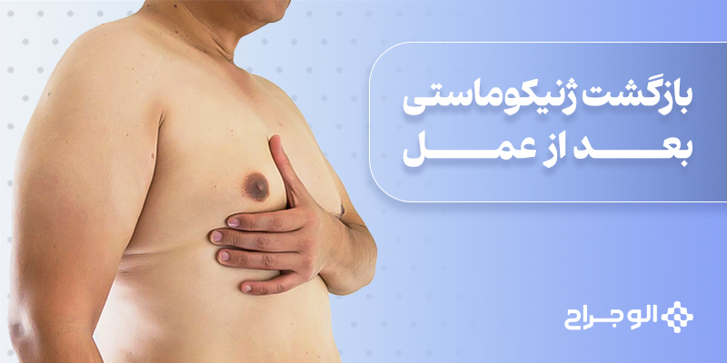 بازگشت ژنیکوماستی بعد از عمل