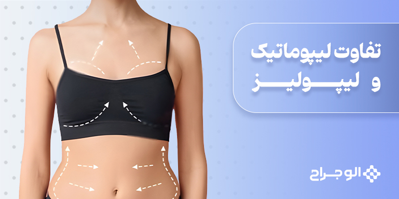 تفاوت لیپوماتیک و لیپولیز