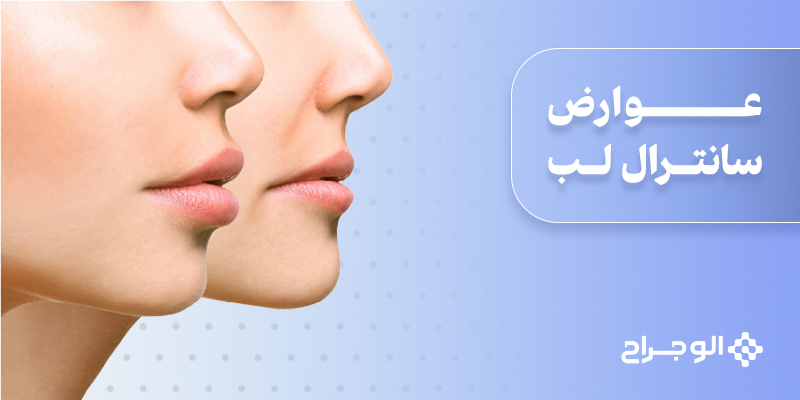 عوارض سانترال لب
