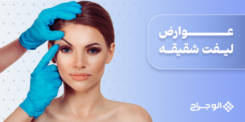 عوارض لیفت شقیقه