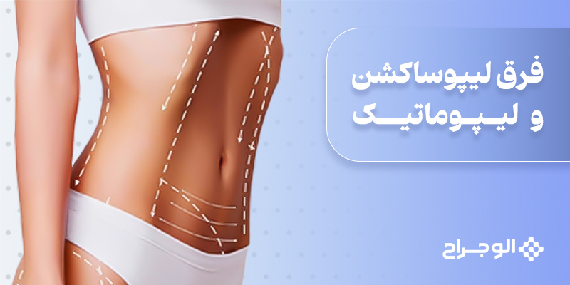 فرق لیپوساکشن و لیپوماتیک