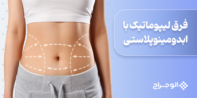 فرق لیپوماتیک با ابدومینوپلاستی