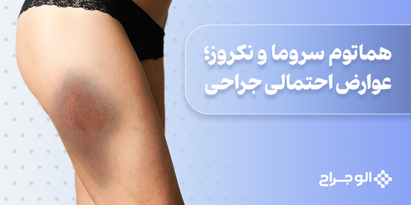 هماتوم_سروما_و_نکروز؛_عوارض_احتمالی_جراحی