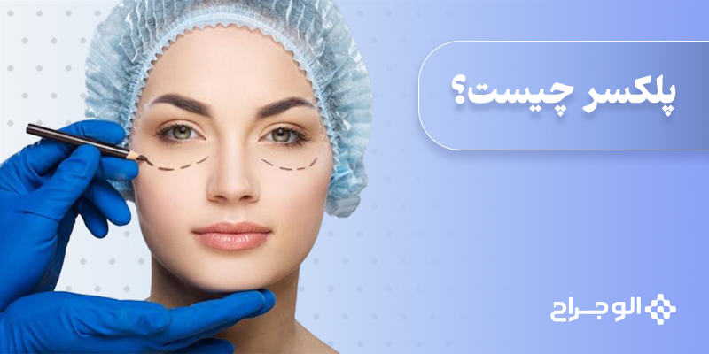 پلکسر چیست؟