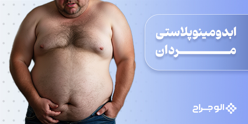 ابدومینوپلاستی مردان
