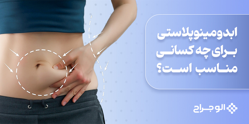 ابدومینوپلاستی_برای_چه_کسانی_مناسب_است؟
