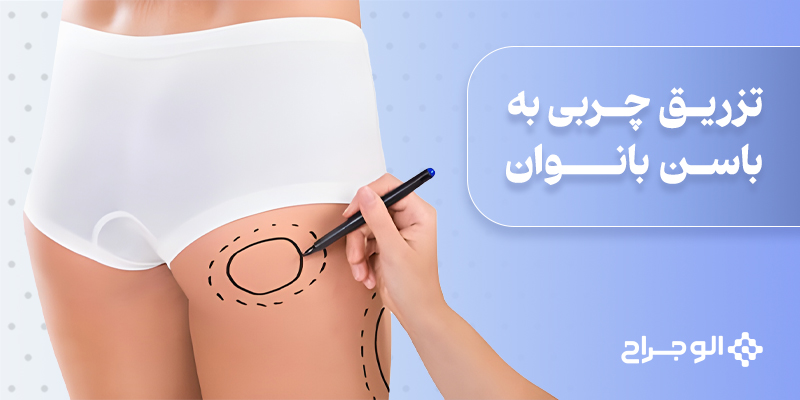تزریق چربی به باسن بانوان