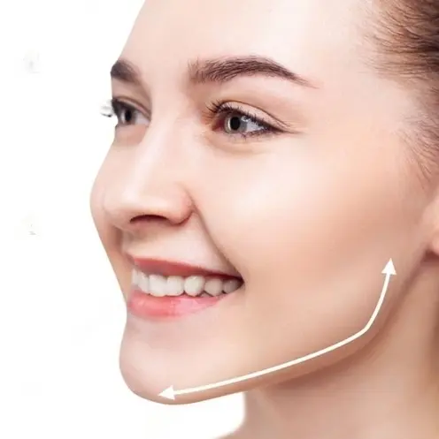 کاشت پروتز فک