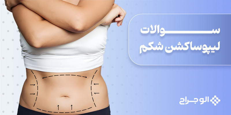 سوالات لیپوساکشن شکم