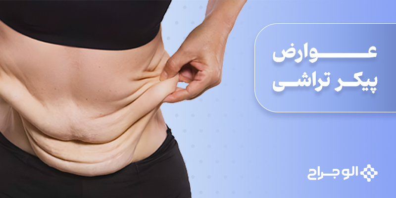 عوارض پیکر تراشی