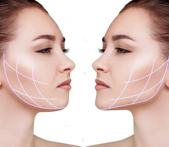 کاشت پروتز فک