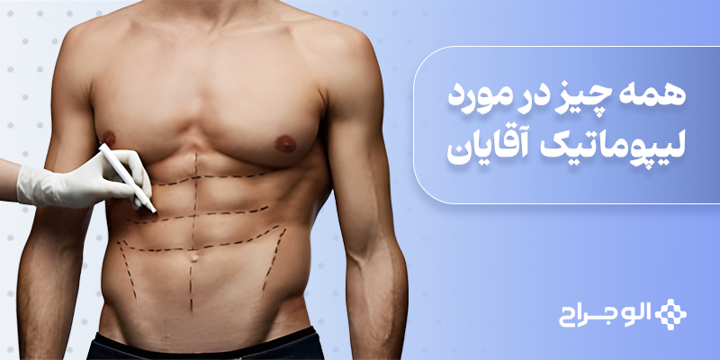 همه_چیز_در_مورد_لیپوماتیک_آقایان