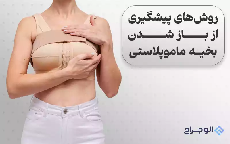 روشهای پیشگیری از باز شدن بخیه ماموپلاستی