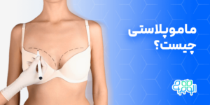 ماموپلاستی چیست؟