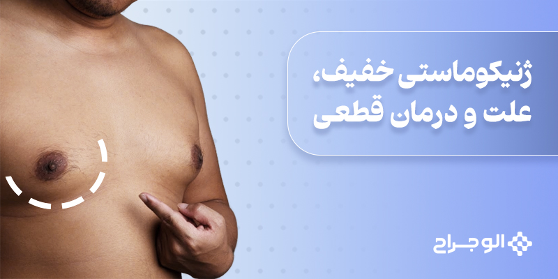ژنیکوماستی_خفیف،_علت_و_درمان_قطعی