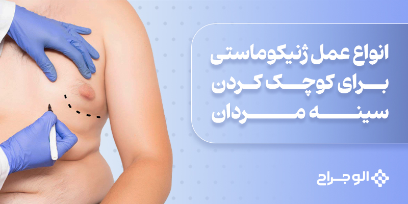انواع عمل ژنیکوماستی چیست؟