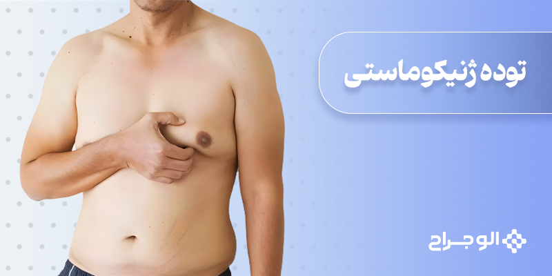توده ژنیکوماستی