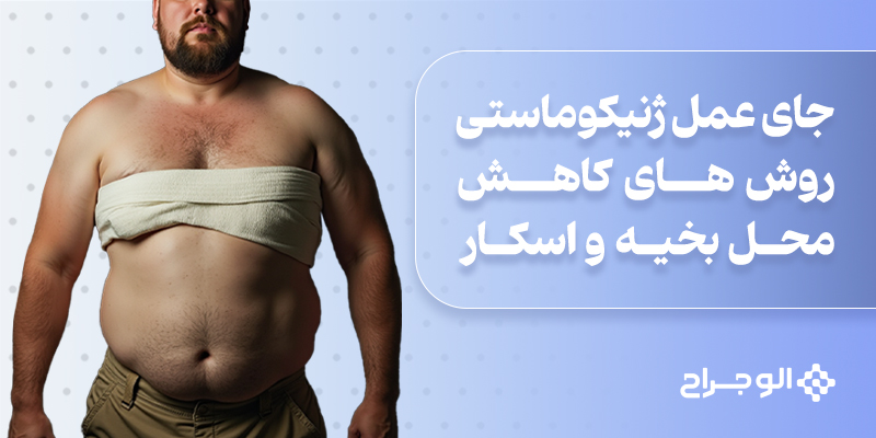 جای عمل ژنیکوماستی: روش‌های کاهش محل بخیه و اسکار