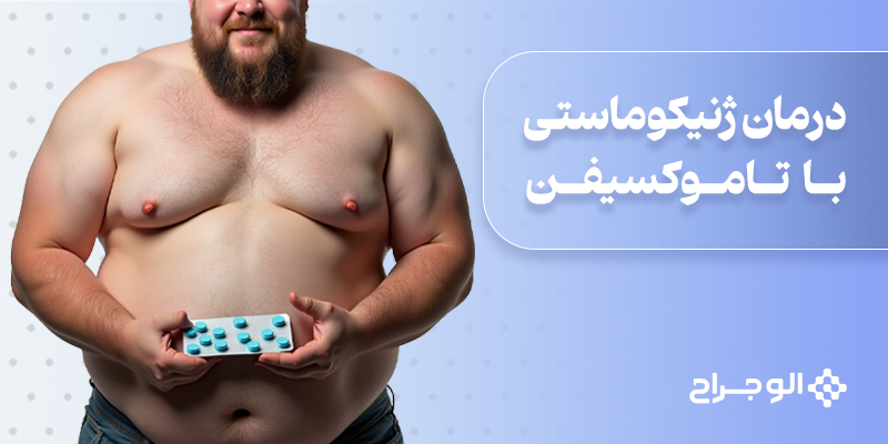 درمان ژنیکوماستی با تاموکسیفن