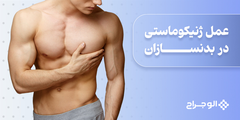 عمل ژنیکوماستی در بدنسازان