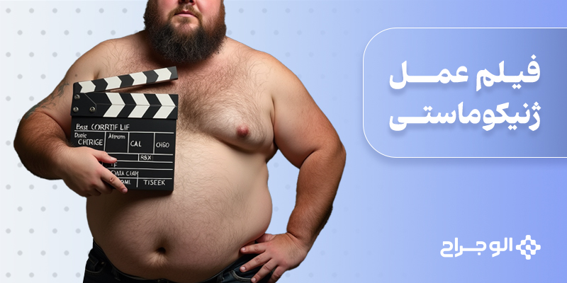 فیلم عمل ژنیکوماستی