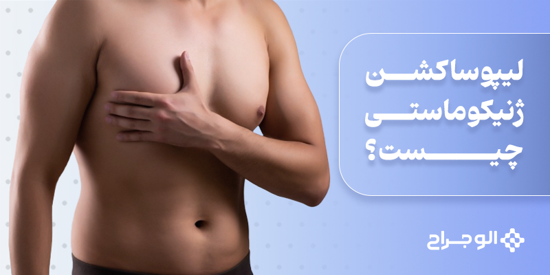 لیپوساکشن ژنیکوماستی چیست؟