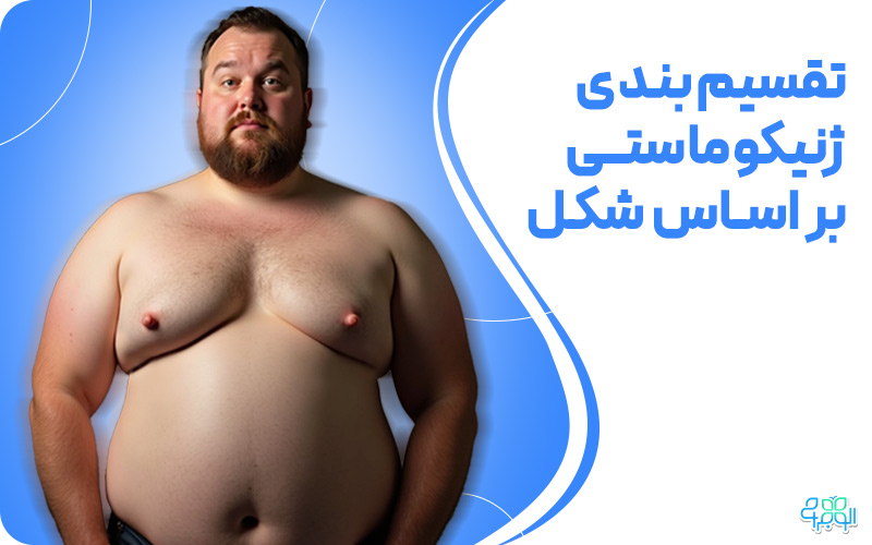 ژنیکوماستی بر اساس شکل