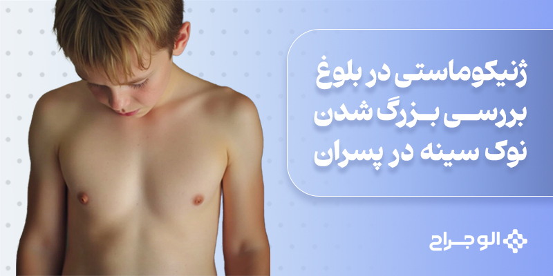 ژنیکوماستی در بلوغ: بررسی کامل بزرگ شدن نوک سینه در پسران