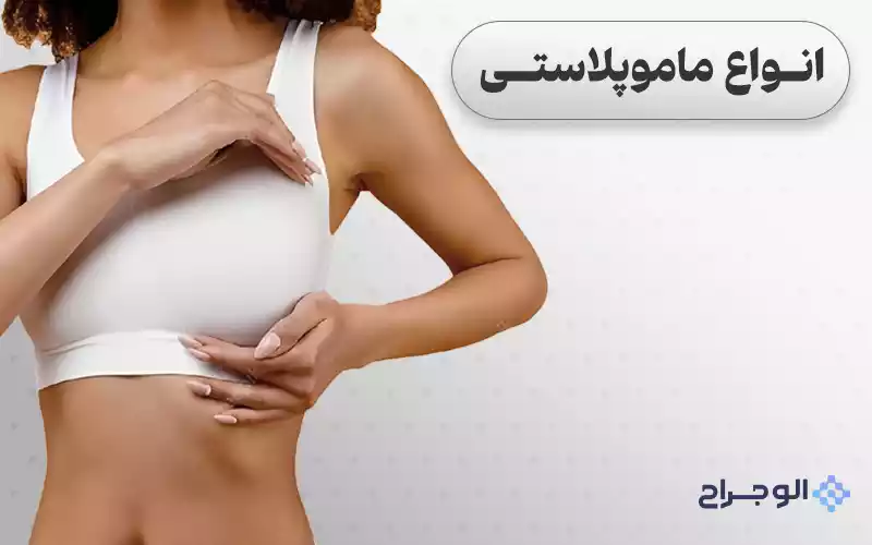 انواع ماموپلاستی