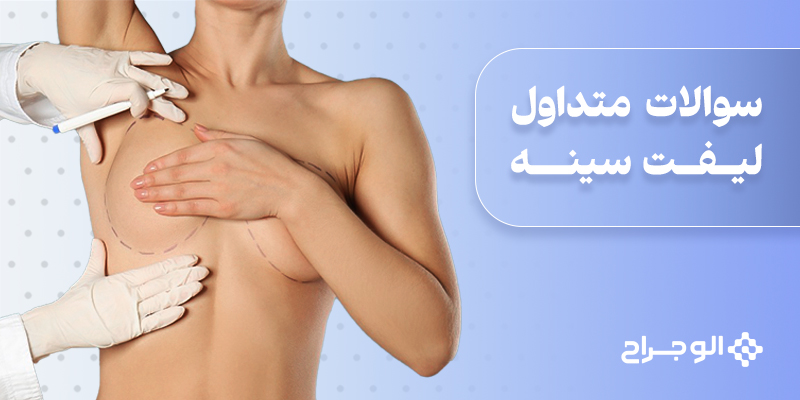 سوالات متداول لیفت سینه