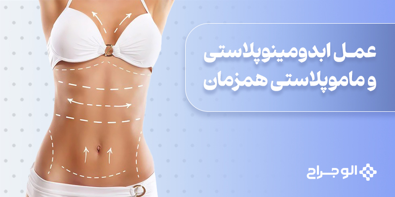 عمل_ابدومینوپلاستی_و_ماموپلاستی_همزمان