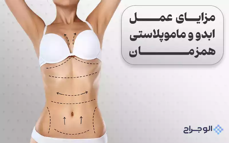 مزایای عمل ابدو و ماموپلاستی همزمان