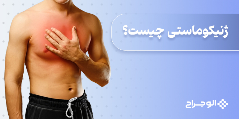 ژنیکوماستی چیست؟