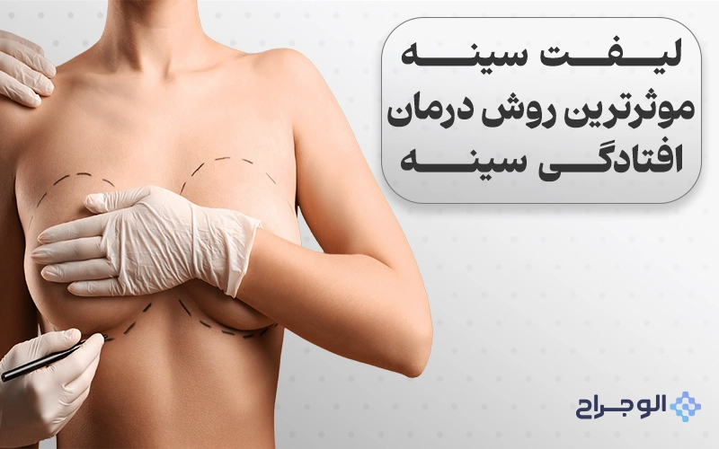 لیفت سینه، مؤثرترین روش درمان افتادگی سینه - الو جراح