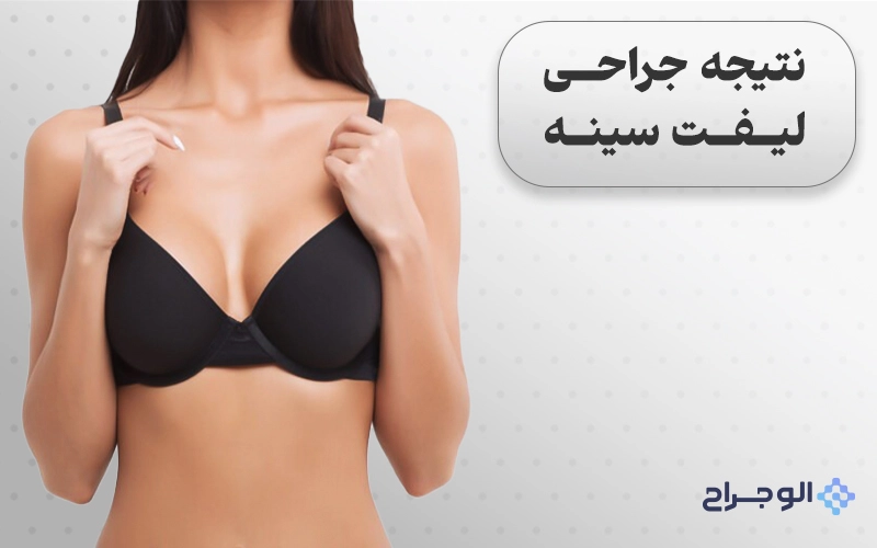 نتیجه جراحی لیفت سینه - الو جراح